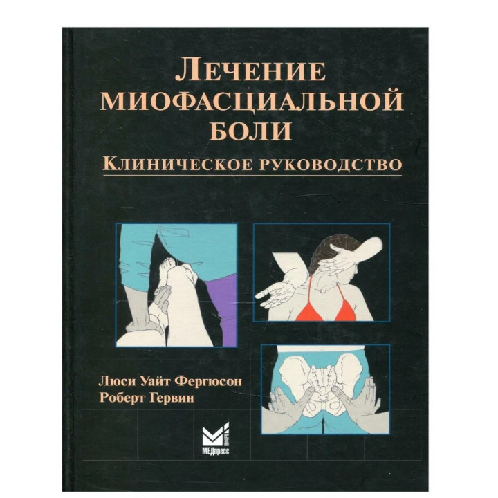 Лечение миофасциальной боли