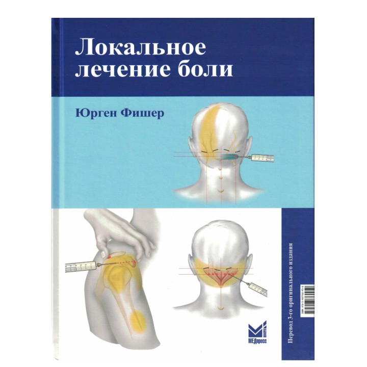 Локальное лечение боли 