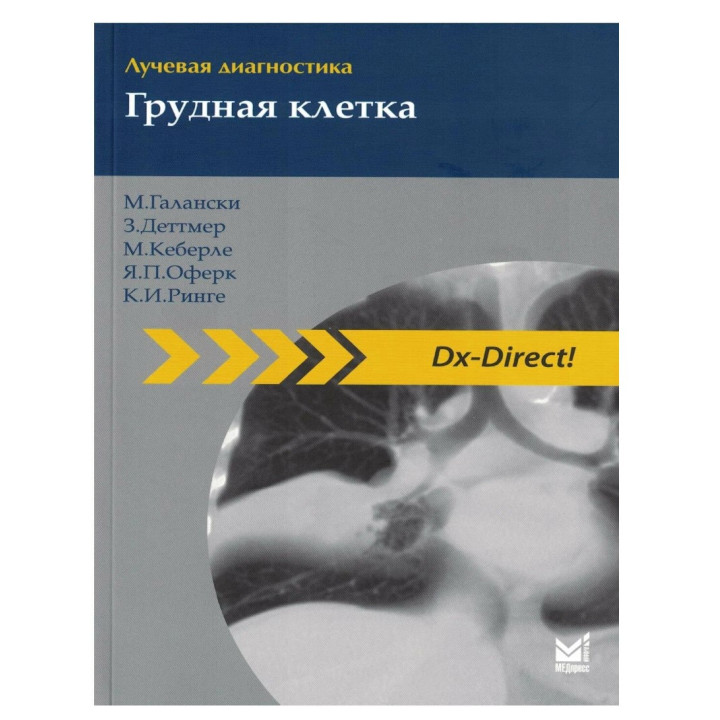 Лучевая диагностика. Грудная клетка 