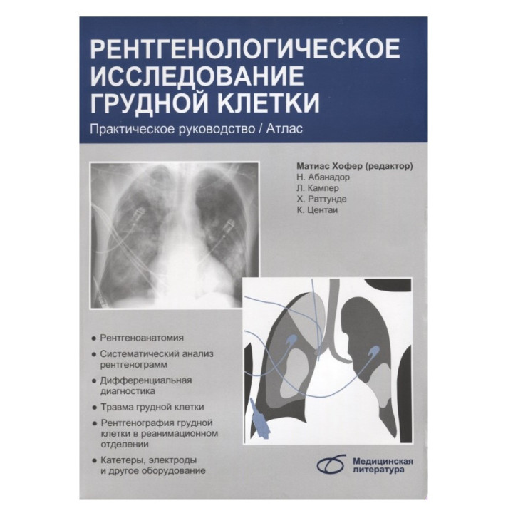 Рентгенологическое исследование грудной клетки. 