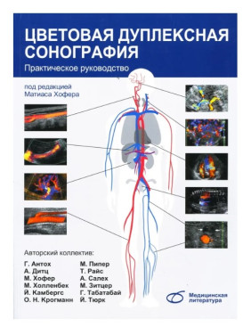 Цветовая дуплексная сонография. Практическое руководство