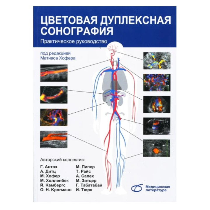Цветовая дуплексная сонография. Практическое руководство